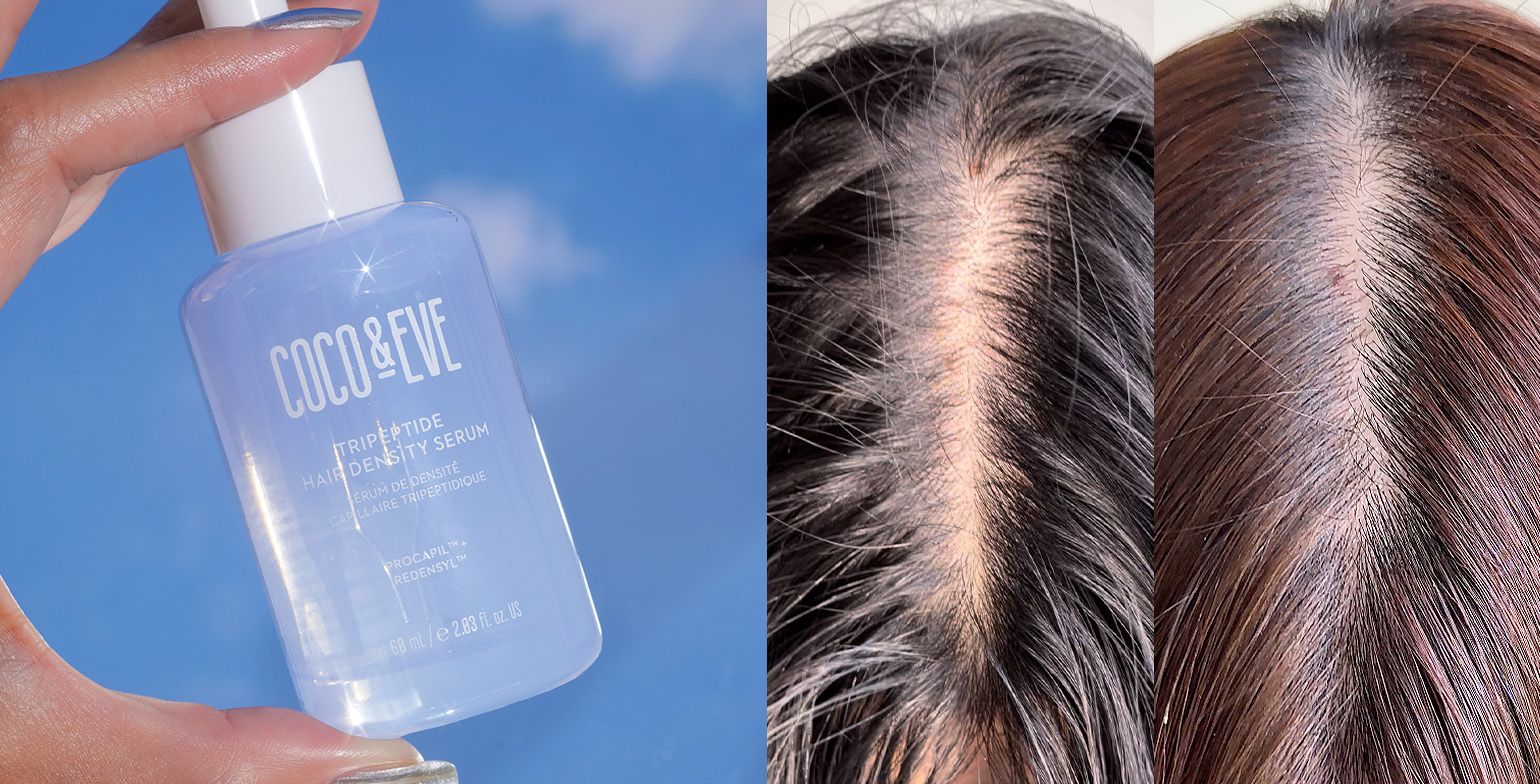 Revive Thinning Hair – One Simple Trick Proven to Boost Hair Density